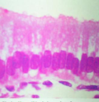 Epitelio cilíndrico (vesícula).JPG
