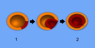 300px-Gastrulation.png