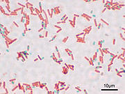 http://upload.wikimedia.org/wikipedia/commons/thumb/7/7a/Bacillus_subtilis_Spore.jpg/180px-Bacillus_subtilis_Spore.jpg