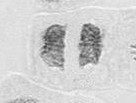 telofase.jpg
